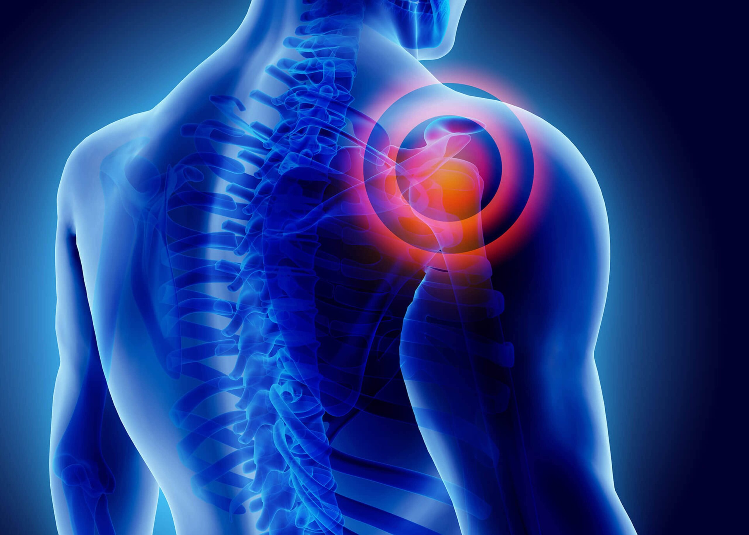 Shoulder dislocation, bicep strain, and more. Come see Dr. Goradia at G2 Orthopedics to treat your shoulder pain. He also provides rotator cuff surgery recovery guides and others to help patients through every stage of treatment and recovery.