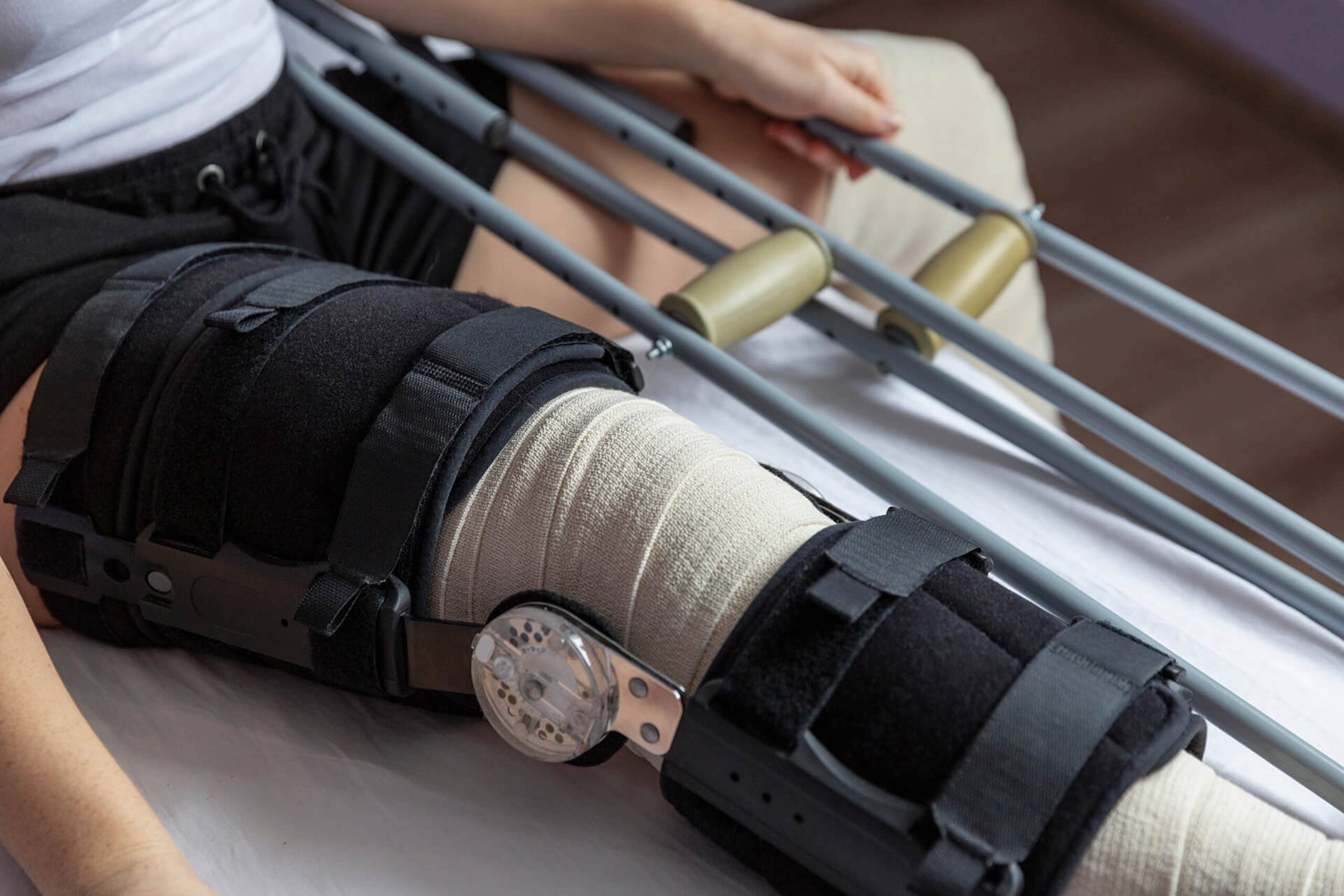 Person holds crutches with their leg in a brace stretched out on an exam table. After outpatient knee replacement surgery, patients generally need to use crutches for 1-2 weeks while they recover. Dr. Goradia of G2 Orthopedics provides all of his patients with an individualized recovery plan to encourage proper healing that suits their individual lifestyles.